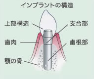 �C���v�����g�̍\��