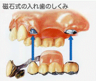 �}�O�t�B�b�g�̎ʐ^